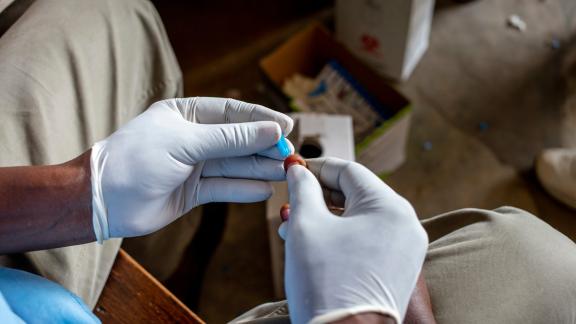 HIV test being administered 