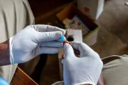HIV test being administered 